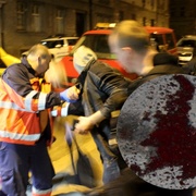 U CAN zkopali muže tak, že skončil v nemocnici s krvácením do mozku