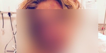 Bosá žena v panické hrůze před útočníkem vyskočila z okna