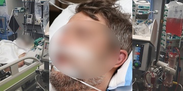 Brácha v nemocnici bojuje o život, je na tom velice špatně a my doufáme, že snad přijde zázrak