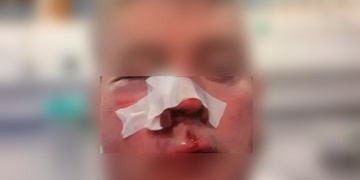 Svědek pomočení auta skončil v krvi