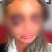 Velmi surové napadení dvou dívek šetří kriminalisté