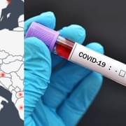 Koronavirus Covid-19 dorazil do Česka