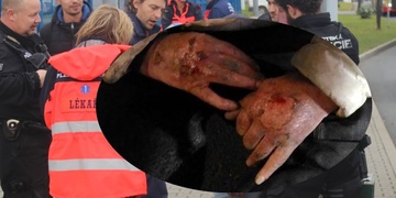 Muž s těžce popálenýma rukama i opilci válející se všude