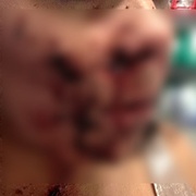 Přepadená žena s rozsekanou hlavou na Lochotíně