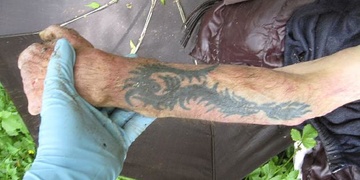 Mrtvý má přednost před umírajícím